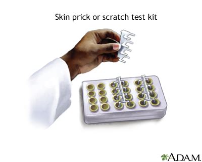 scratch test definition science|understanding skin scratch tests.